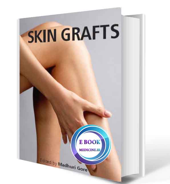 دانلود کتابSkin Grafts  (ORIGINAL PDF)